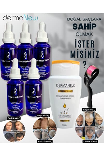dermanew hair Saç Gürleştirici Serum - Dökülme Karşıtı Şampuan Roller Hediyeli /5x50ml