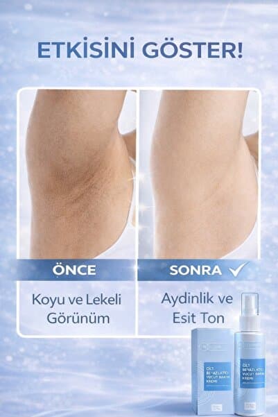 NG Kozmetik Arbutin ve Meyan Kökü Özlü Diz,Dirsek, Koltukaltı, Genital Bölge Beyazlatıcı Cilt Kremi 100 ML