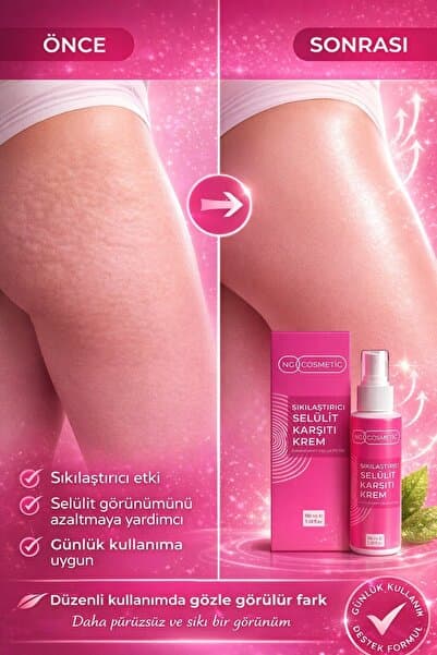 NG Kozmetik Selülit ve Çatlak Karşıtı Bakım Kremi - Coenzyme Q10 & Kafein Etkili Sıkılaştırıcı 100 ML