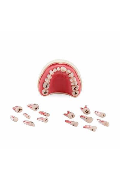 mallofdent 14 Dişli Fantom Endodontik Yarım Çene (Kronlu Çürüklü) - Diş Hekimliği Eğitim Ürünleri