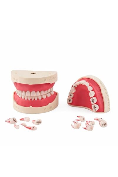 mallofdent 24 Dişli Fantom (Pedo) Endodontik Tam Çene (Kronlu Çürüklü) - Diş Hekimliği Eğitim Ürünleri