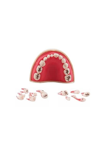 mallofdent 12 Dişli Fantom (Pedo) Endodontik Yarım Çene (Kronlu Çürüklü) - Diş Hekimliği Eğitim Ürünleri