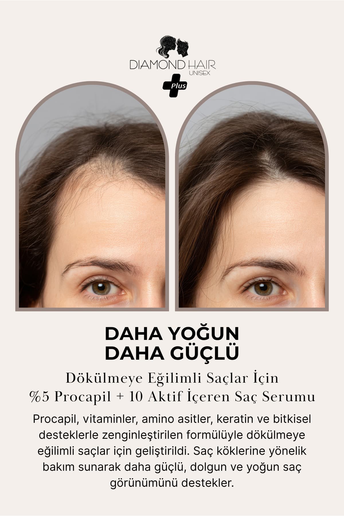 Diamond Hair Saç Serumu Keratinli Peptid Procapil Saç Dökülmesi için Yorumları